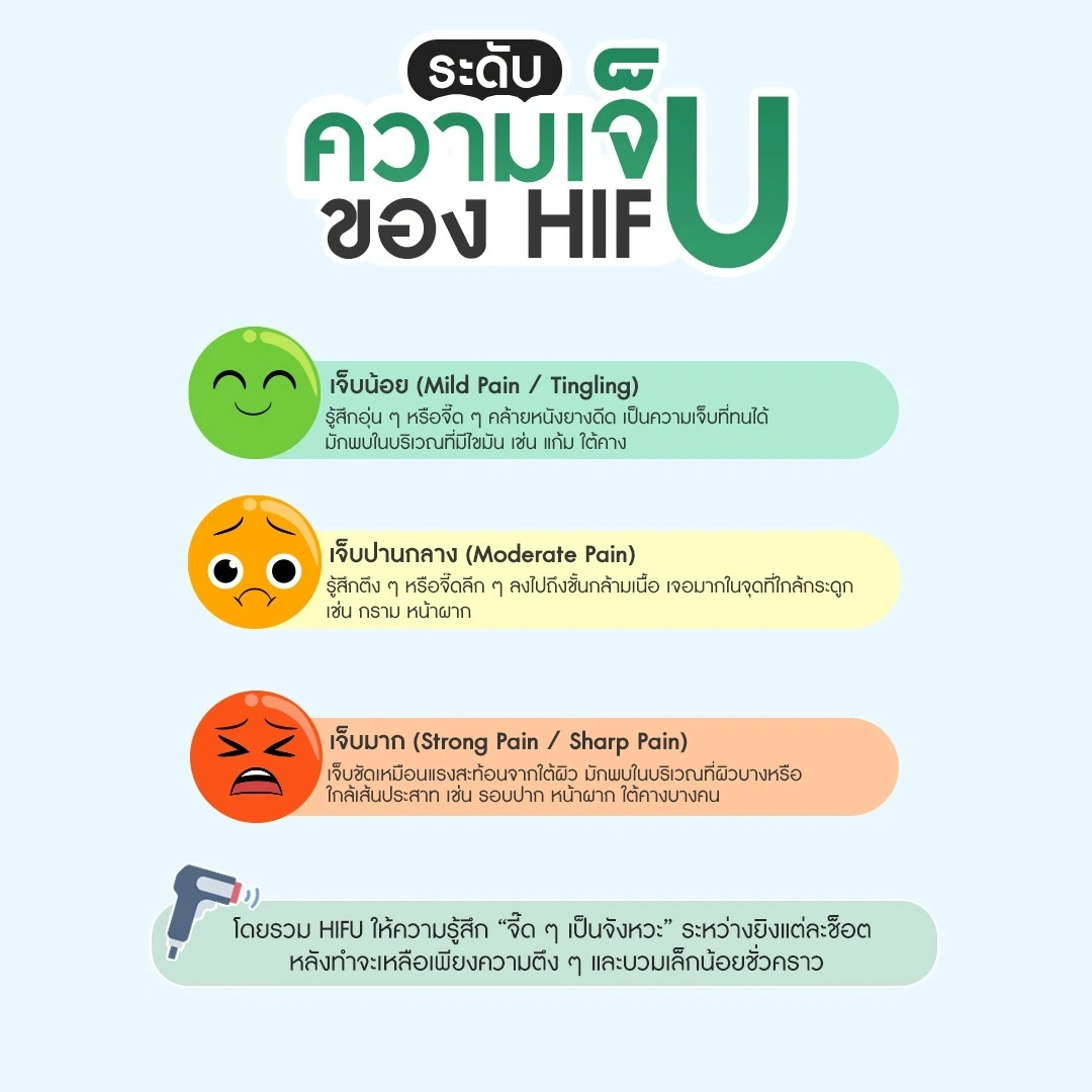 ระดับความเจ็บ ของการทำ HIFU