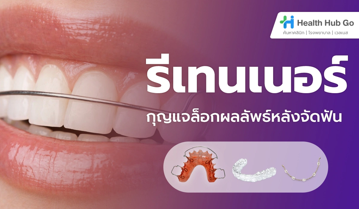 รีเทนเนอร์สำคัญอย่างไร กุญแจล็อกผลลัพธ์หลังจัดฟัน