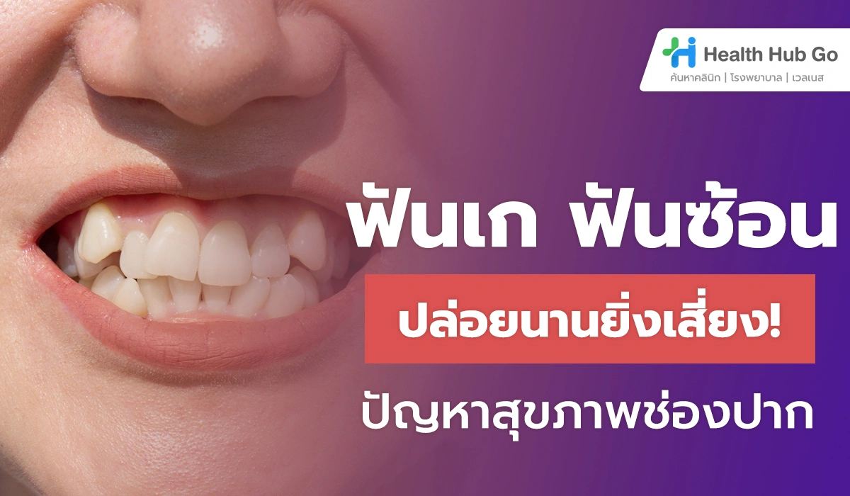 ฟันเก ฟันซ้อน ปล่อยนานยิ่งเสี่ยง ปัญหาสุขภาพช่องปาก