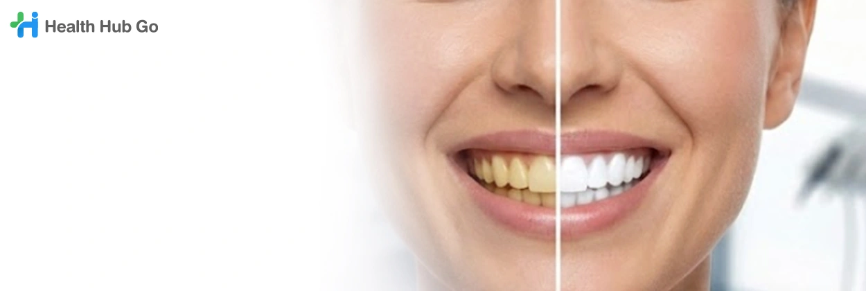 ฟอกสีฟัน