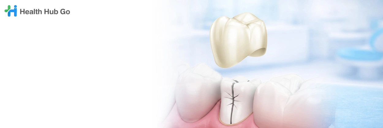 ครอบฟันเซอร์โคเนีย
