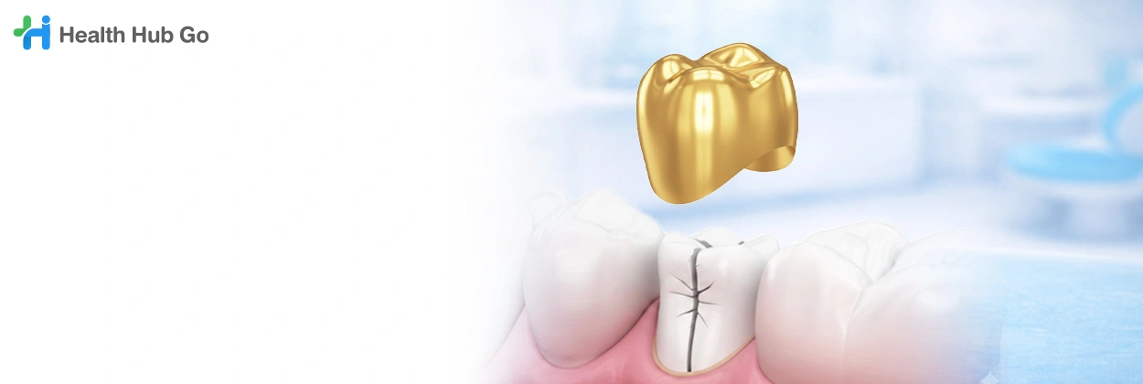 ครอบฟันทองคำ
