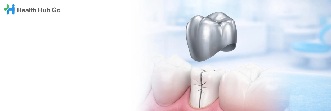ครอบฟันโลหะ