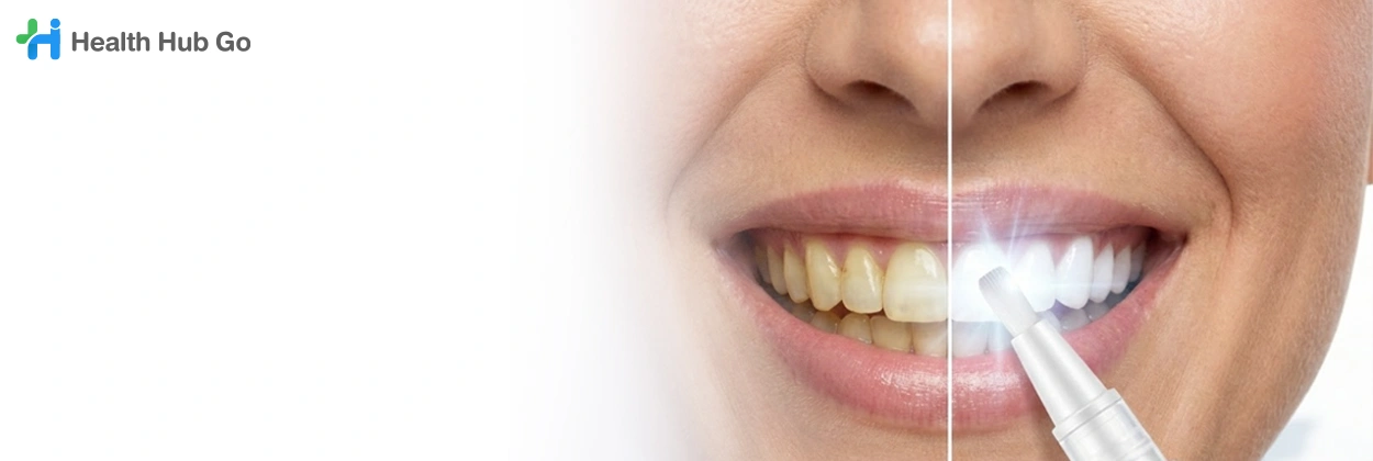 ฟอกสีฟันแบบปากกา