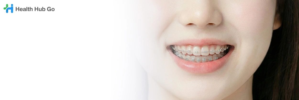 จัดฟันดามอน