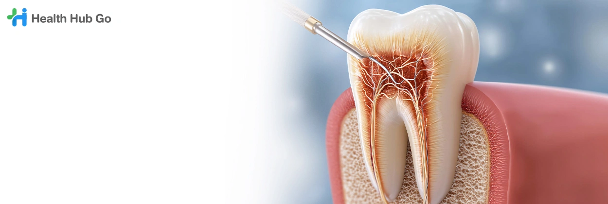 รักษารากฟัน