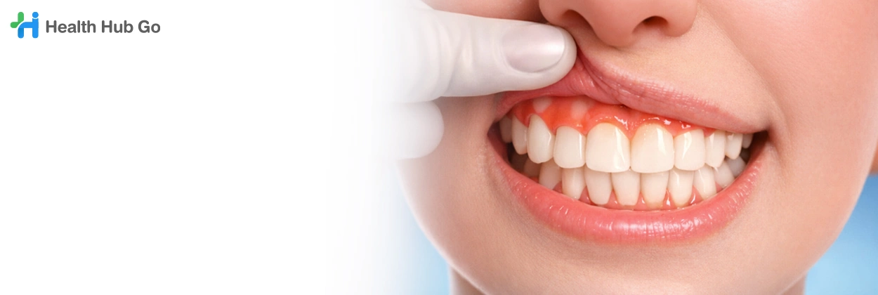 รักษาเหงือก