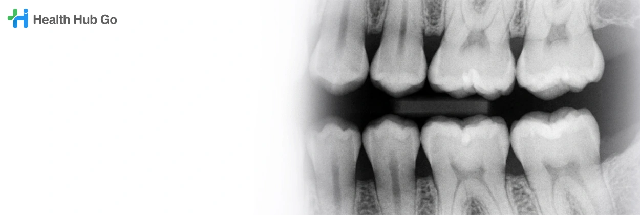 เอกซเรย์การสบฟัน