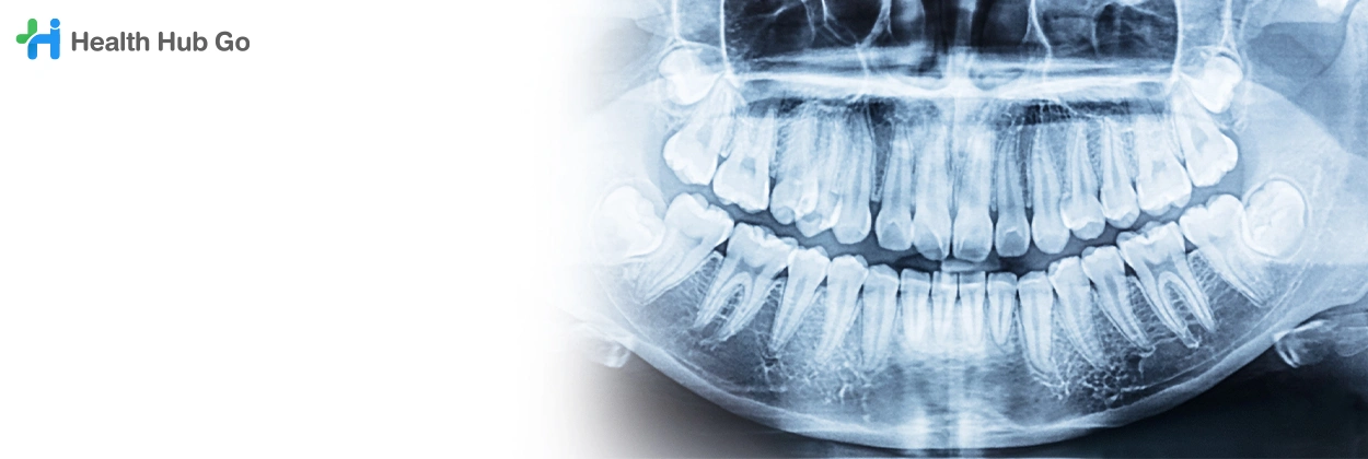 เอกซเรย์ฟัน