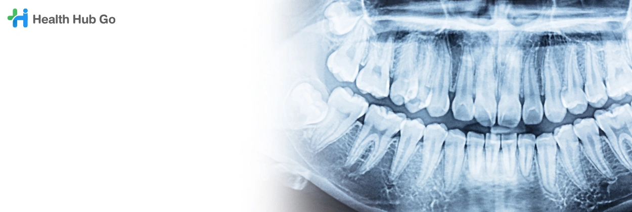 เอกซเรย์ฟันกรามด้านใน
