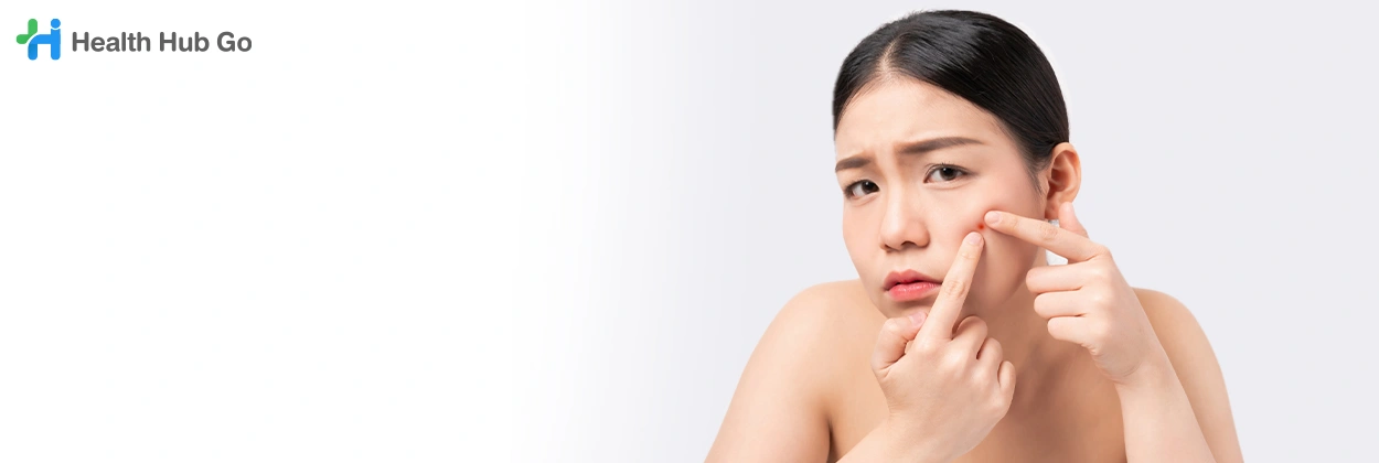 รักษาสิว