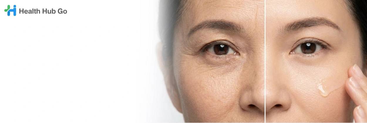 ลดริ้วรอย