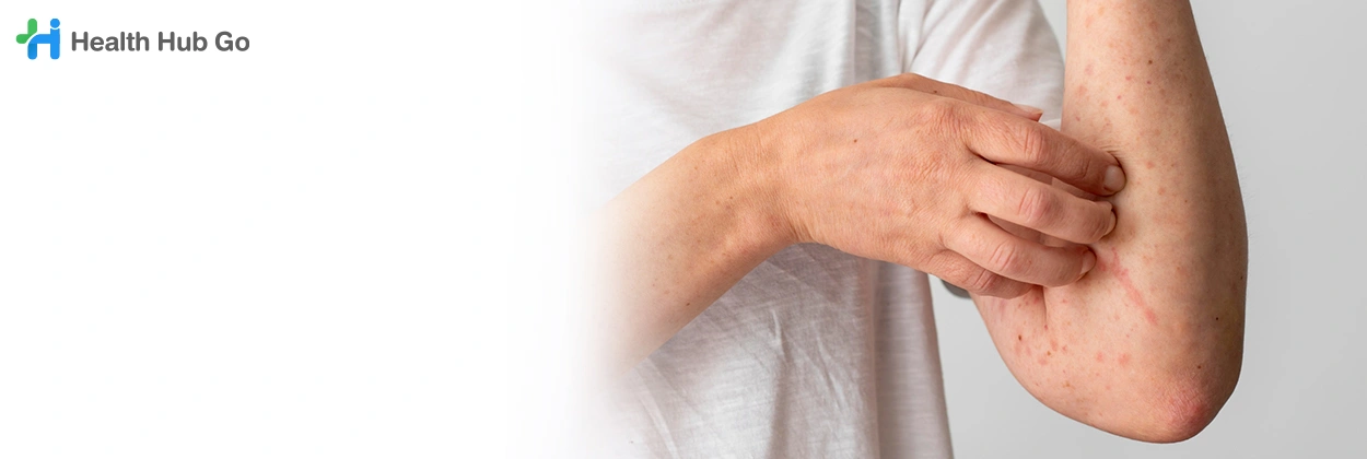 โรคผิวหนัง