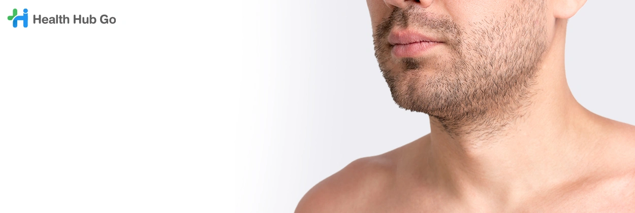 เลเซอร์ขนเครา