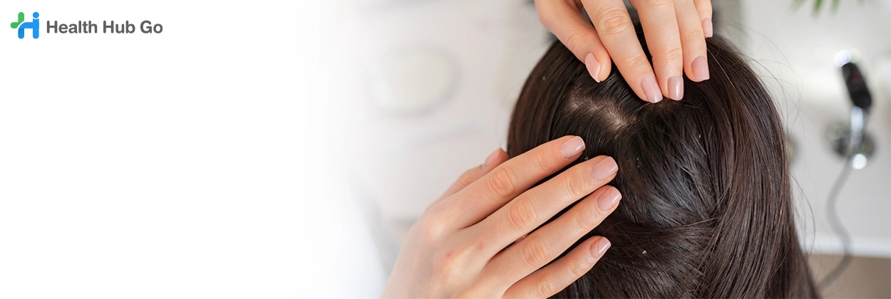 รักษาผมบาง