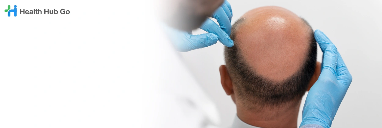 รักษาศีรษะล้าน