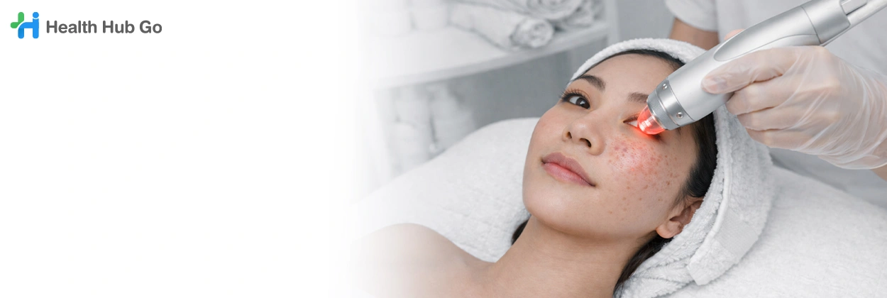 เลเซอร์รอยสิว