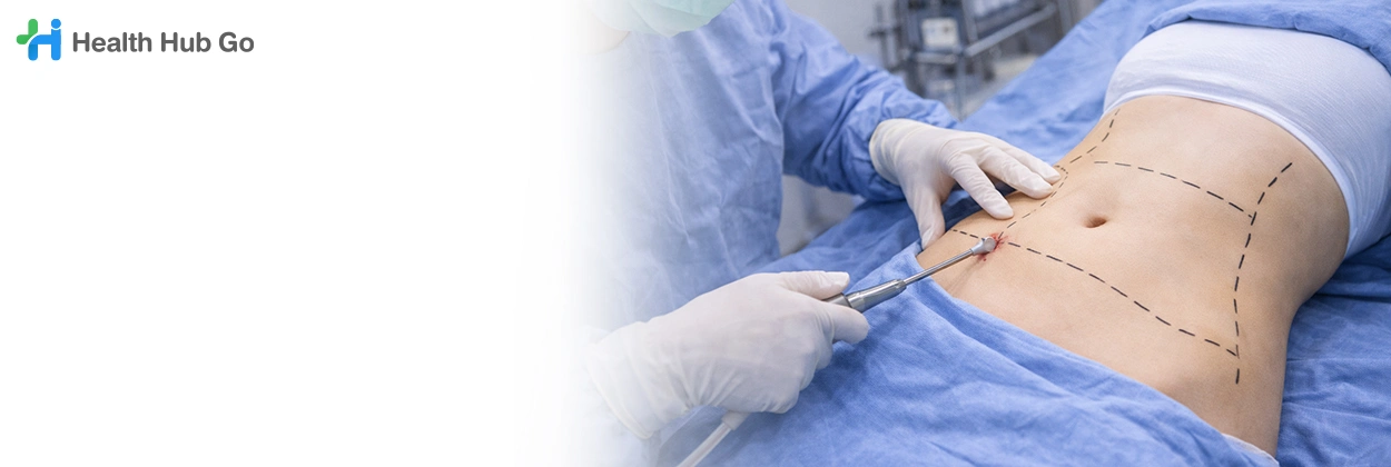 ศัลยกรรมปรับรูปร่าง