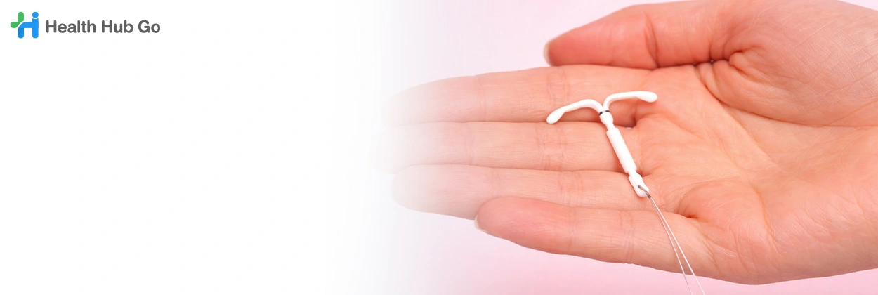 ถอดห่วงคุมกำเนิด