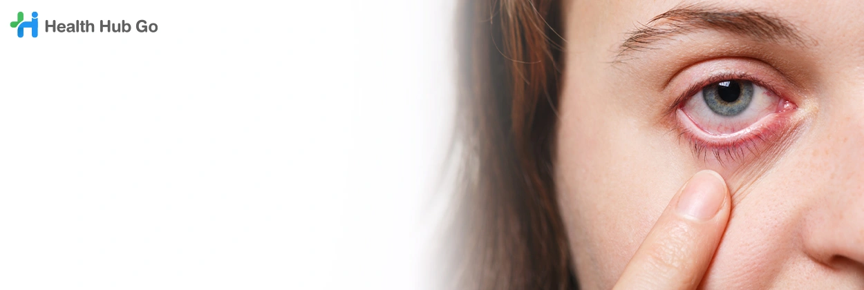 ตรวจเส้นประสาทตา