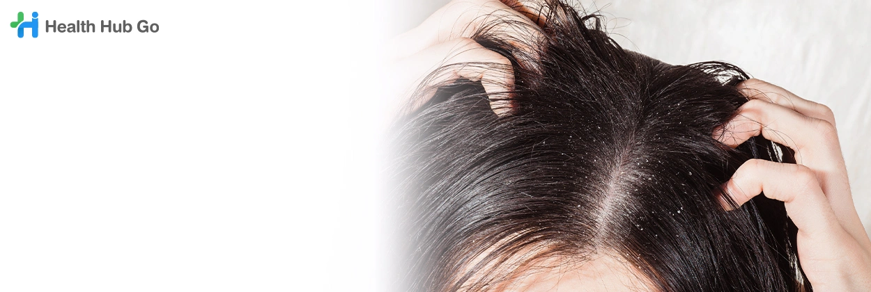 ตรวจสุขภาพหนังศีรษะ