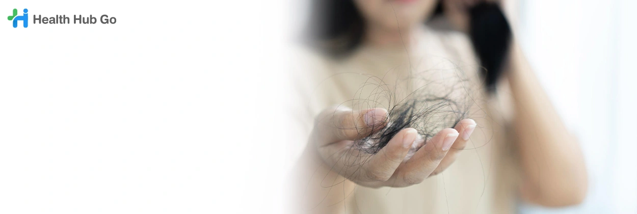 รักษาผมร่วง