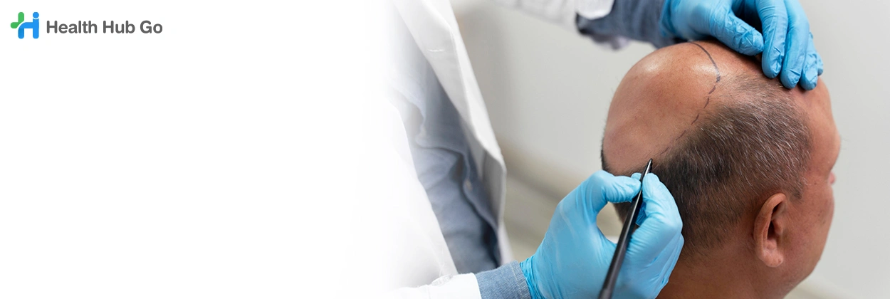 รักษาศีรษะล้าน