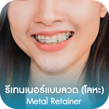 รีเทนเนอร์แบบลวด (โลหะ)