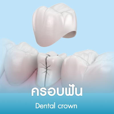 ครอบฟัน