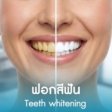 ฟอกสีฟัน