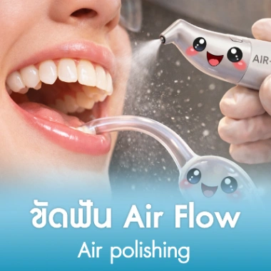 ขัดฟัน Air Flow