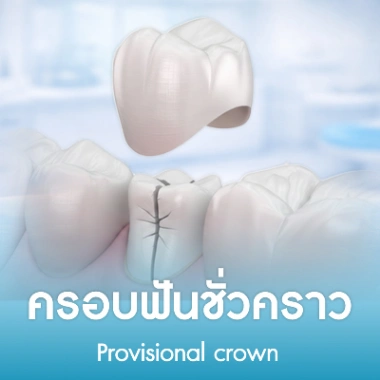 ครอบฟันชั่วคราว