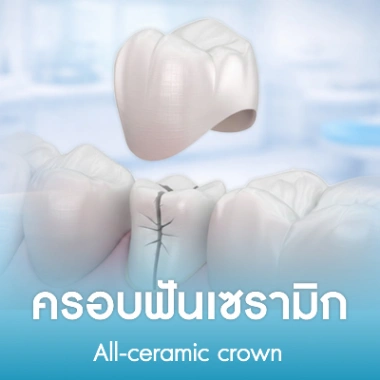 ครอบฟันเซรามิก