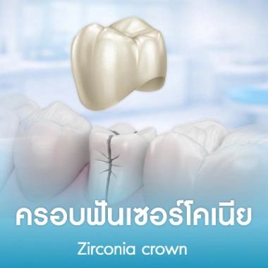 ครอบฟันเซอร์โคเนีย