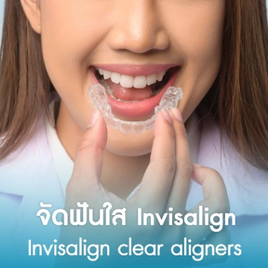 จัดฟันใส Invisalign 