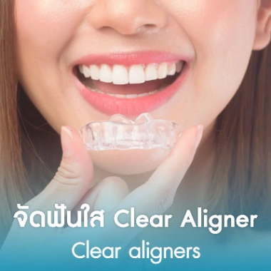จัดฟันใส Clear Aligner