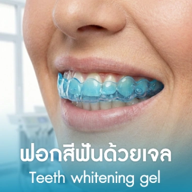 ฟอกสีฟันด้วยเจล