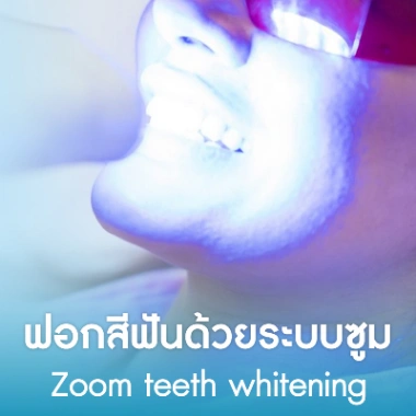 ฟอกสีฟันด้วยระบบซูม