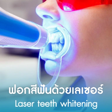 ฟอกสีฟันด้วยเลเซอร์