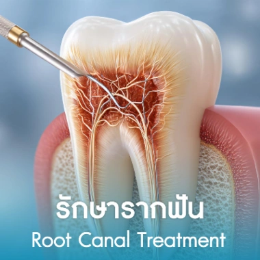รักษารากฟัน