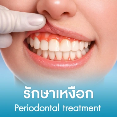 รักษาเหงือก