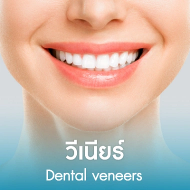 วีเนียร์