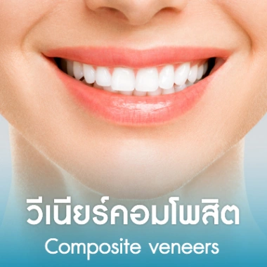 วีเนียร์คอมโพสิต