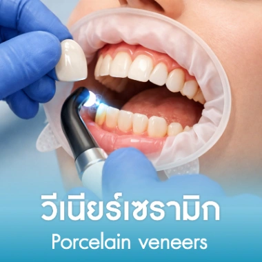 วีเนียร์เซรามิก