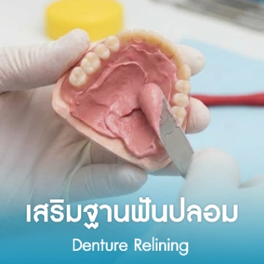 เสริมฐานฟันปลอม