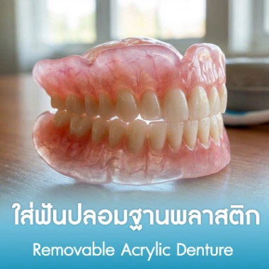ใส่ฟันปลอมฐานพลาสติก