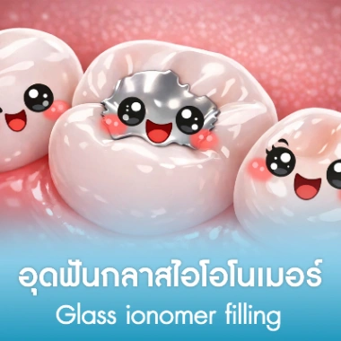 อุดฟันกลาสไอโอโนเมอร์