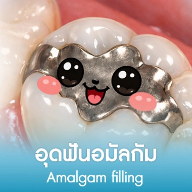 อุดฟันอมัลกัม