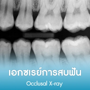เอกซเรย์การสบฟัน