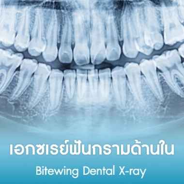 เอกซเรย์ฟันกรามด้านใน